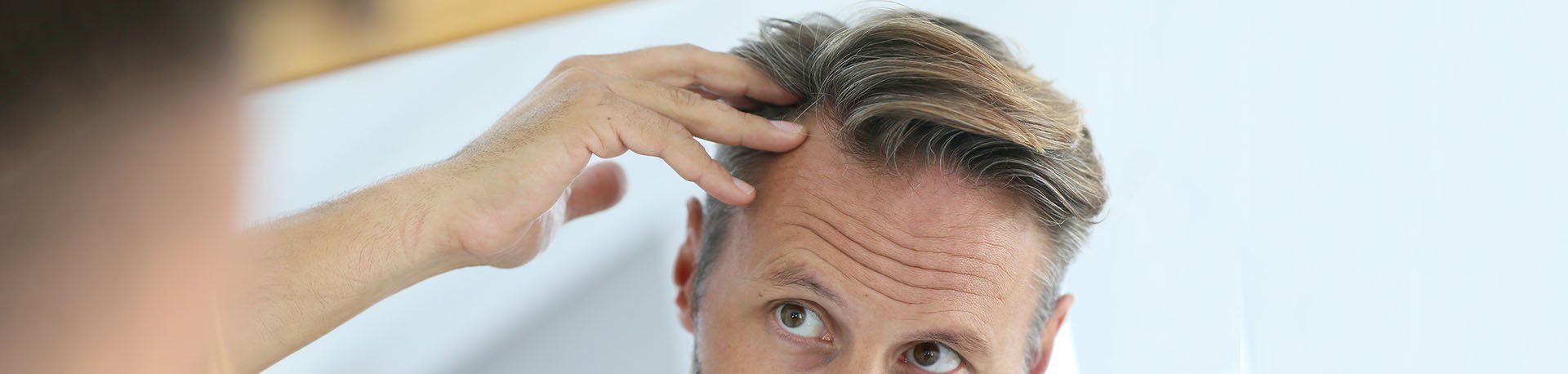هرچیزی که در مورد ریزش مو باید بدانید